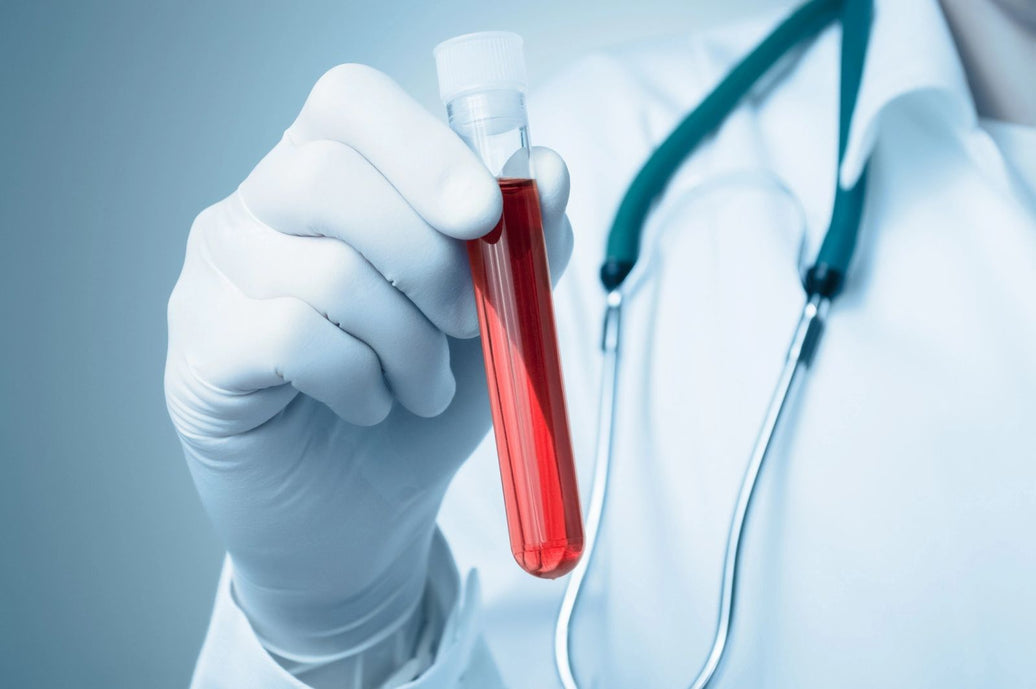 Optimal vs. Normal Lab Ranges: Why the Difference Matters